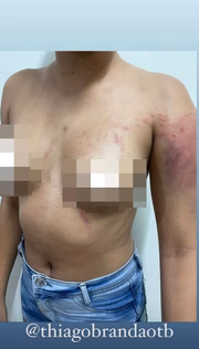 Thiago Brandão usou uma arma de fogo para dar coronhadas