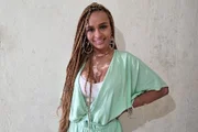 A mineira chegou a fazer tratamentos dolorosos durante a infância para conter o vitiligo, mas, após alguns anos, decidiu que as marcas não seriam um problema e as assumiu