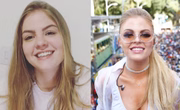 Antes e depois do sorriso de Luísa Sonza