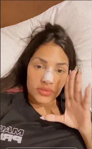 Flay fez uma cirurgia no nariz 