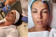 Descrito como não invasivo, o método conquistou celebridades como Deborah Secco e Ana Hickmann