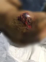 Um suspeito fugiu durante a operação 