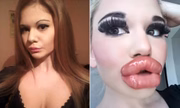 O antes e depois impressiona
