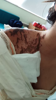 Ela ficou três meses internada no Hospital Leforte, em São Paulo