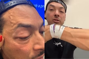 O deputado Felipe Franco alega ter sido agredido por seguranças no show do cantor Chris Brown no Allianz Parque, nesse domingo (22/12)